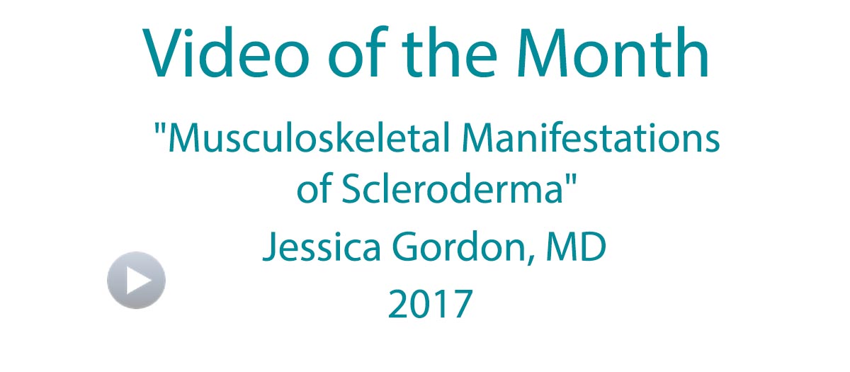 Scleroderma Video of the Month